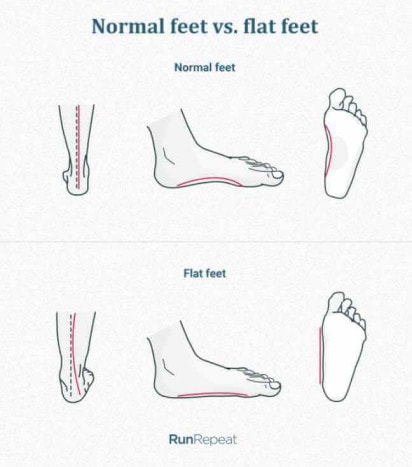 telapak kaki manusia berbeda